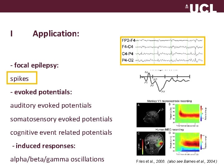 I Application: - focal epilepsy: spikes - evoked potentials: auditory evoked potentials somatosensory evoked