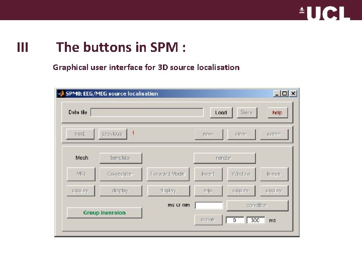 III The buttons in SPM : Graphical user interface for 3 D source localisation