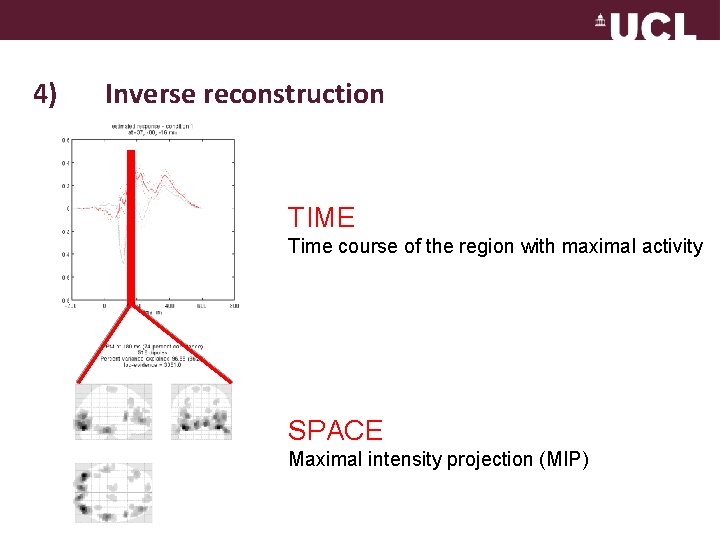 4) Inverse reconstruction TIME Time course of the region with maximal activity SPACE Maximal