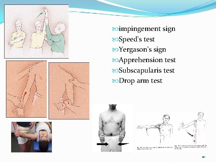  resim impingement sign Speed's test Yergason's sign Apprehension test Subscapularis test Drop arm