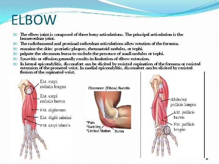 ELBOW The elbow joint is composed of three bony articulations. The principal articulation is