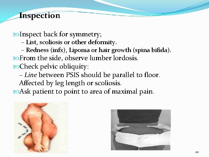 Inspection Inspect back for symmetry; – List, scoliosis or other deformity. – Redness (infx),