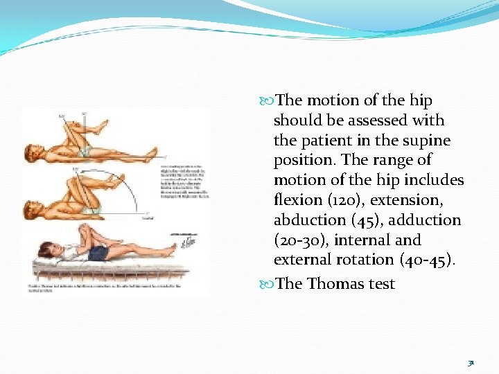  The motion of the hip should be assessed with the patient in the