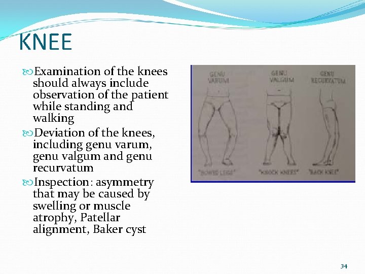 KNEE Examination of the knees should always include observation of the patient while standing