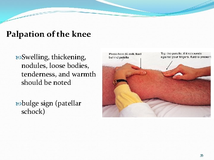Palpation of the knee Swelling, thickening, nodules, loose bodies, tenderness, and warmth should be
