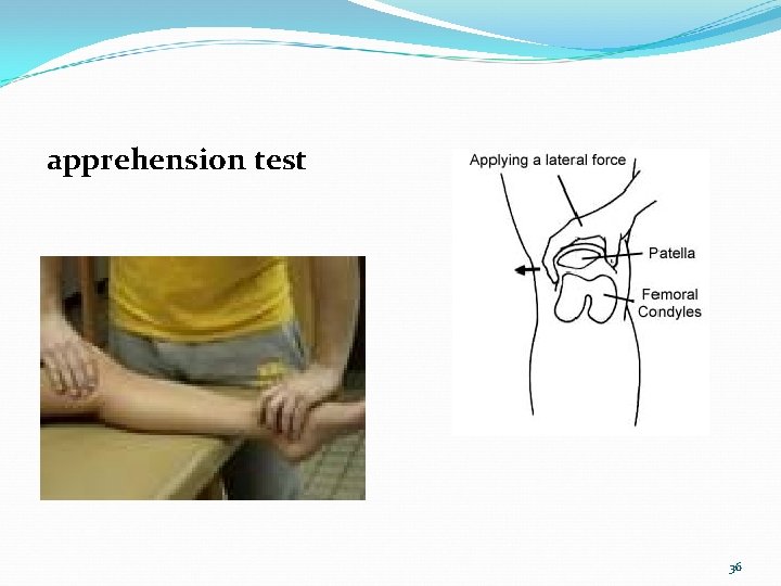 apprehension test 36 