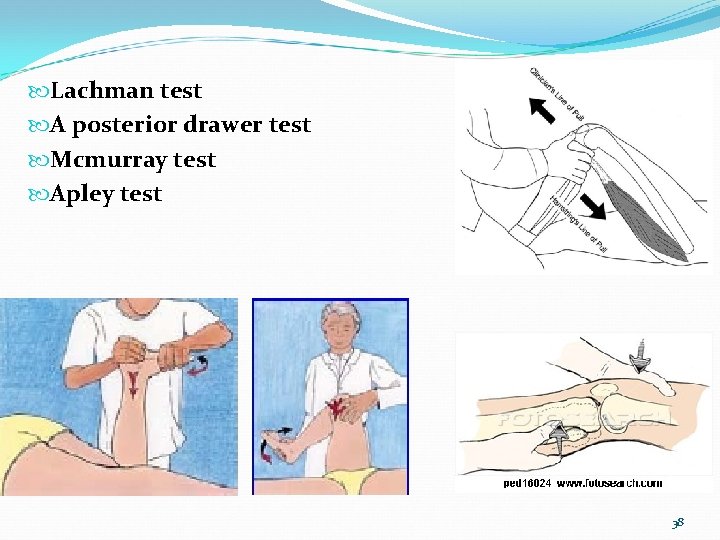  Lachman test A posterior drawer test Mcmurray test Apley test 38 