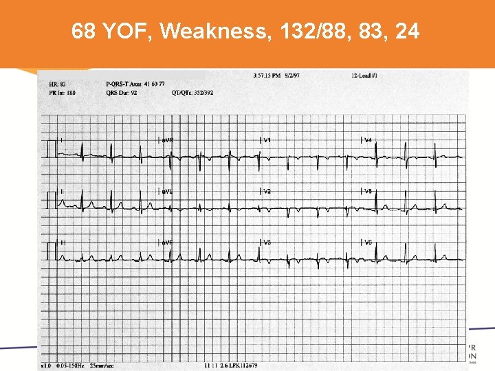 68 YOF, Weakness, 132/88, 83, 24 