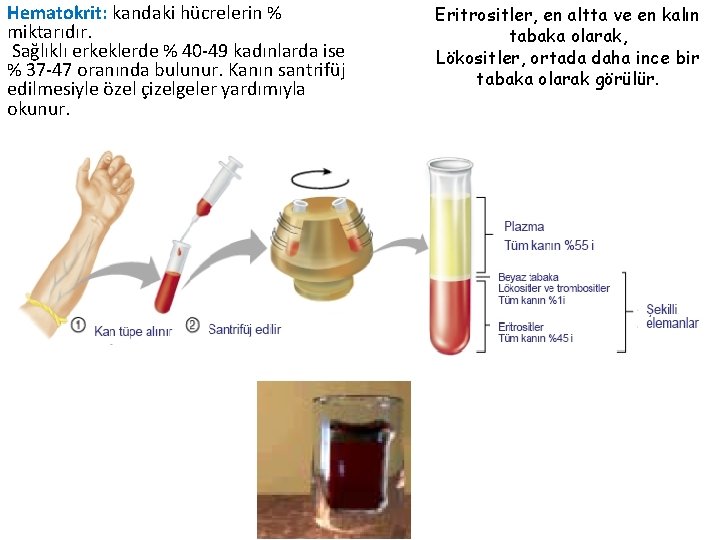 Hematokrit: kandaki hücrelerin % miktarıdır. Sağlıklı erkeklerde % 40 -49 kadınlarda ise % 37