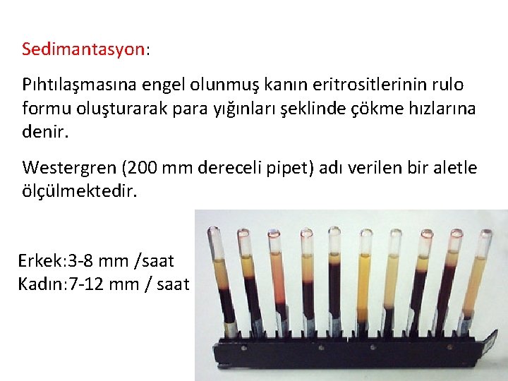 Sedimantasyon: Pıhtılaşmasına engel olunmuş kanın eritrositlerinin rulo formu oluşturarak para yığınları şeklinde çökme hızlarına