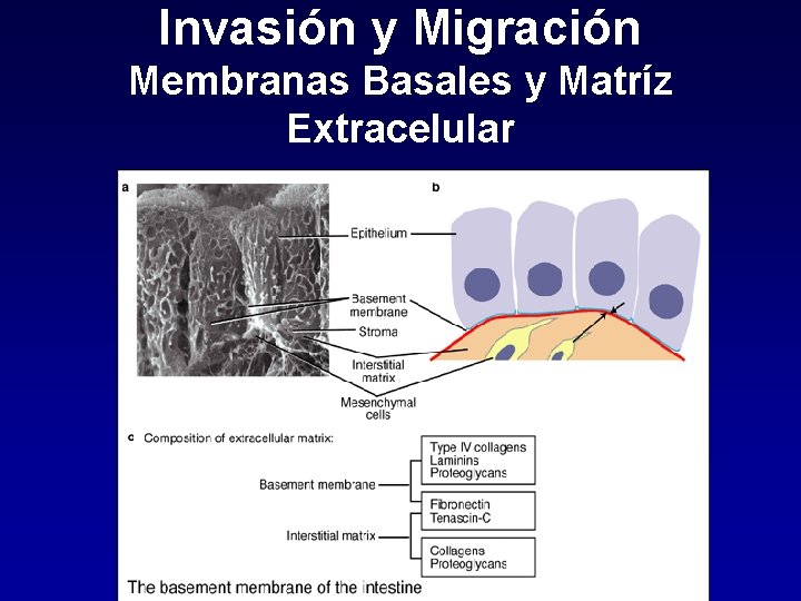 Invasión y Migración Membranas Basales y Matríz Extracelular 