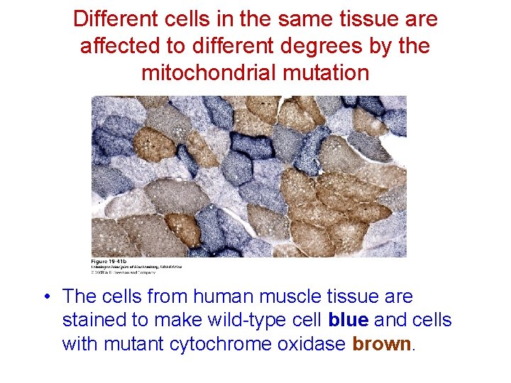 Different cells in the same tissue are affected to different degrees by the mitochondrial