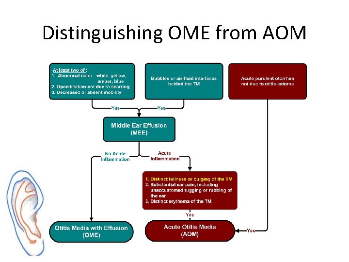 Distinguishing OME from AOM 