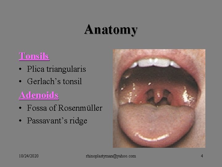Anatomy Tonsils • Plica triangularis • Gerlach’s tonsil Adenoids • Fossa of Rosenmüller • Anatomy Tonsils • Plica triangularis • Gerlach’s tonsil Adenoids • Fossa of Rosenmüller •