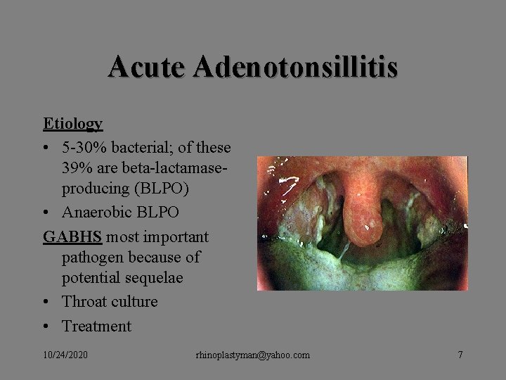 Acute Adenotonsillitis Etiology • 5 -30% bacterial; of these 39% are beta-lactamaseproducing (BLPO) • Acute Adenotonsillitis Etiology • 5 -30% bacterial; of these 39% are beta-lactamaseproducing (BLPO) •