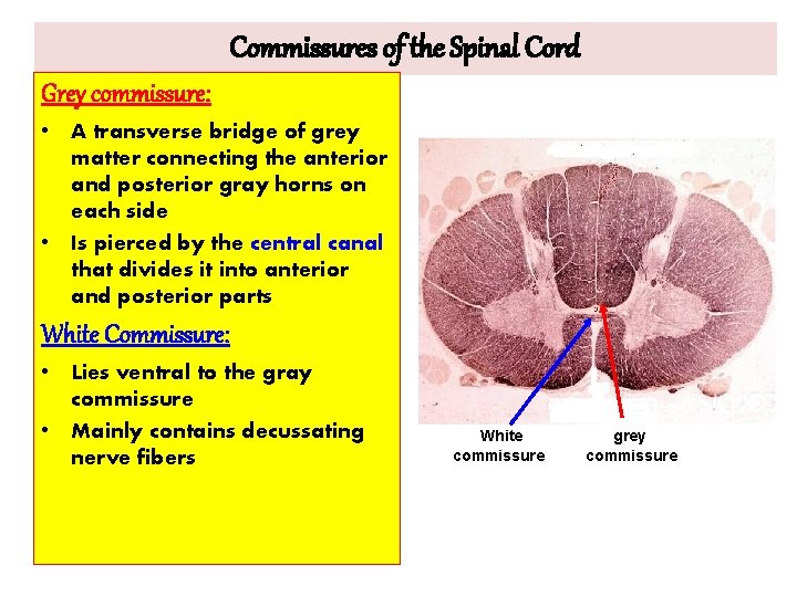 Commissures of the Spinal Cord Grey commissure: • A transverse bridge of grey matter