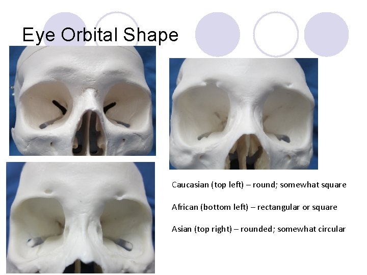 Eye Orbital Shape Caucasian (top left) – round; somewhat square African (bottom left) –