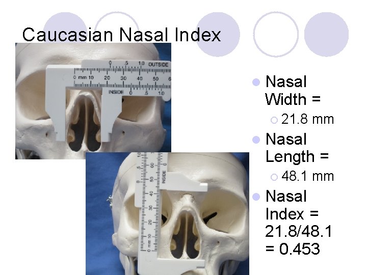 Caucasian Nasal Index l Nasal Width = ¡ 21. 8 mm l Nasal Length