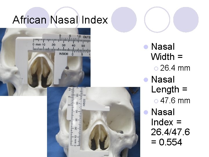 African Nasal Index l Nasal Width = ¡ 26. 4 mm l Nasal Length