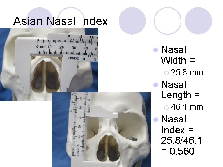 Asian Nasal Index l Nasal Width = ¡ 25. 8 mm l Nasal Length