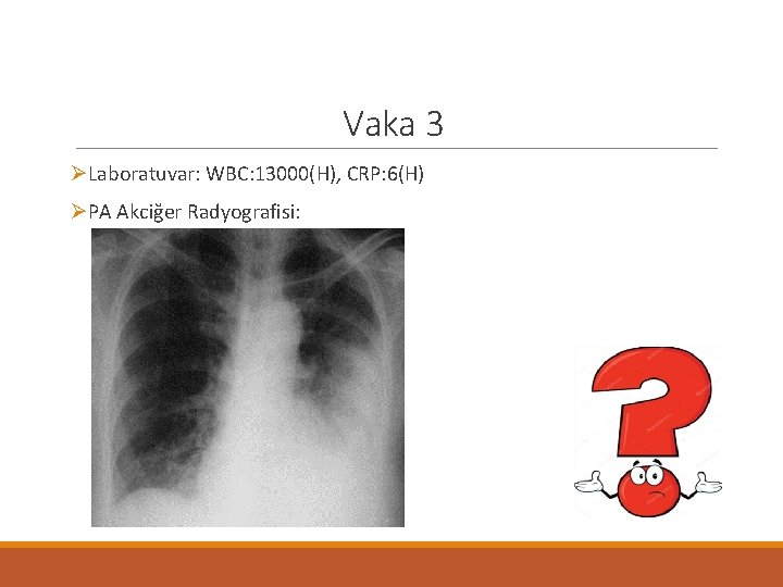 Vaka 3 ØLaboratuvar: WBC: 13000(H), CRP: 6(H) ØPA Akciğer Radyografisi: 