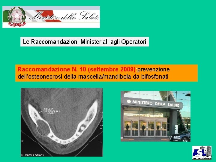 Le Raccomandazioni Ministeriali agli Operatori Raccomandazione N. 10 (settembre 2009): prevenzione dell’osteonecrosi della mascella/mandibola