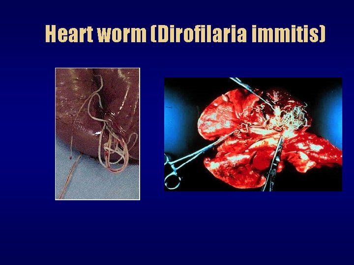 Heart worm (Dirofilaria immitis) 