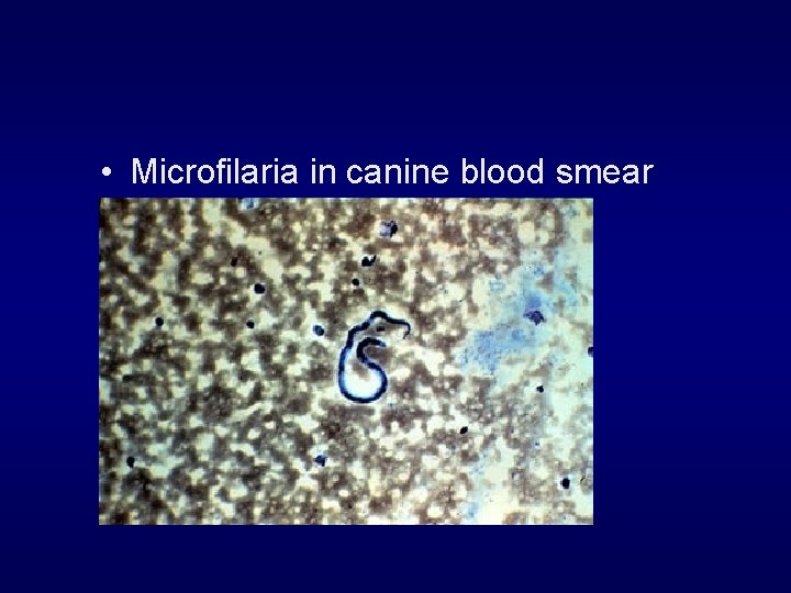  • Microfilaria in canine blood smear 