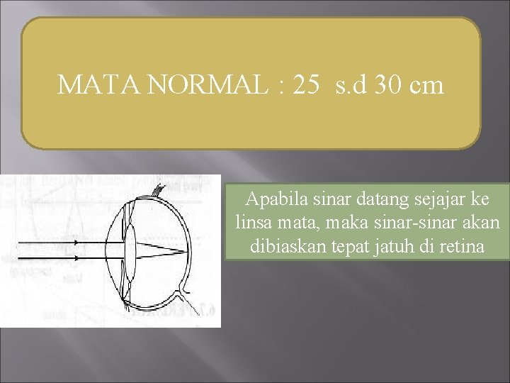 MATA NORMAL : 25 s. d 30 cm Apabila sinar datang sejajar ke linsa