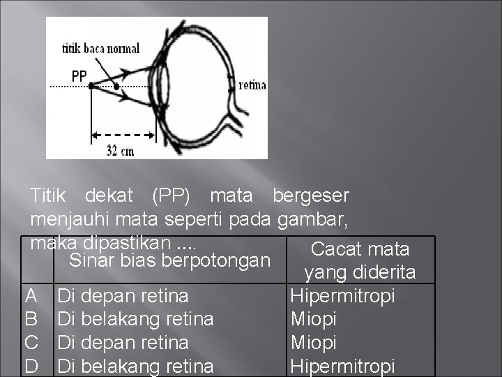 Titik dekat (PP) mata bergeser menjauhi mata seperti pada gambar, maka dipastikan …. Cacat