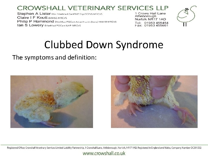 Clubbed Down Syndrome The symptoms and definition: 