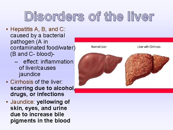 Disorders of the liver • Hepatitis A, B, and C: caused by a bacterial