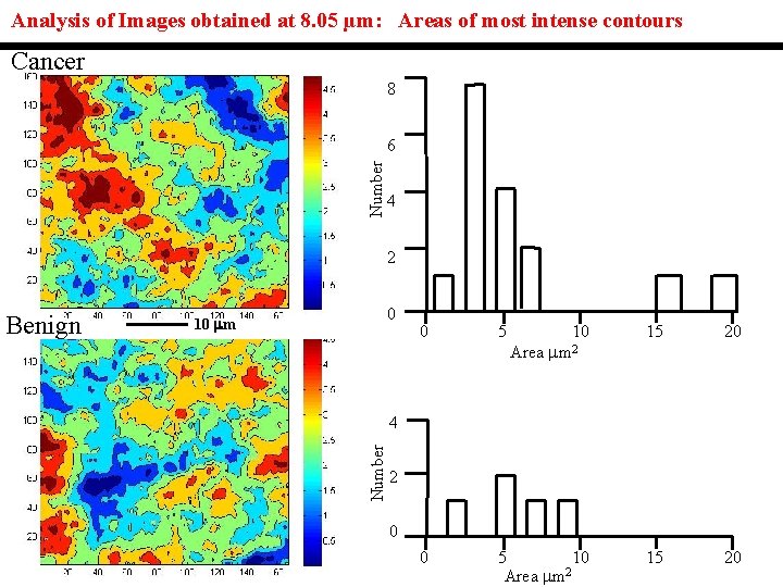 Analysis of Images obtained at 8. 05 µm: Areas of most intense contours Cancer Analysis of Images obtained at 8. 05 µm: Areas of most intense contours Cancer