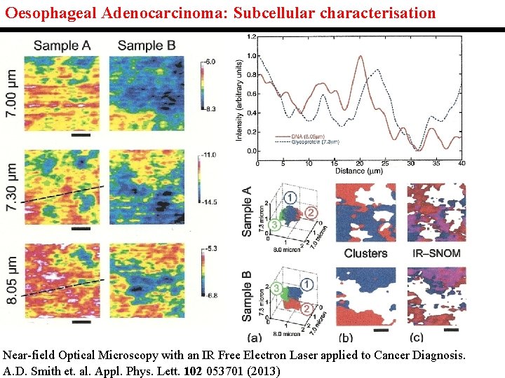 Oesophageal Adenocarcinoma: Subcellular characterisation Near-field Optical Microscopy with an IR Free Electron Laser applied Oesophageal Adenocarcinoma: Subcellular characterisation Near-field Optical Microscopy with an IR Free Electron Laser applied