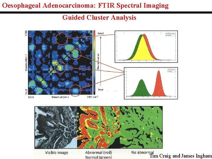 Oesophageal Adenocarcinoma: FTIR Spectral Imaging Guided Cluster Analysis Tim Craig and James Ingham Oesophageal Adenocarcinoma: FTIR Spectral Imaging Guided Cluster Analysis Tim Craig and James Ingham