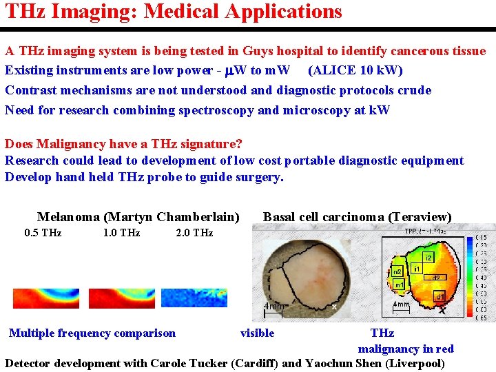 THz Imaging: Medical Applications A THz imaging system is being tested in Guys hospital THz Imaging: Medical Applications A THz imaging system is being tested in Guys hospital