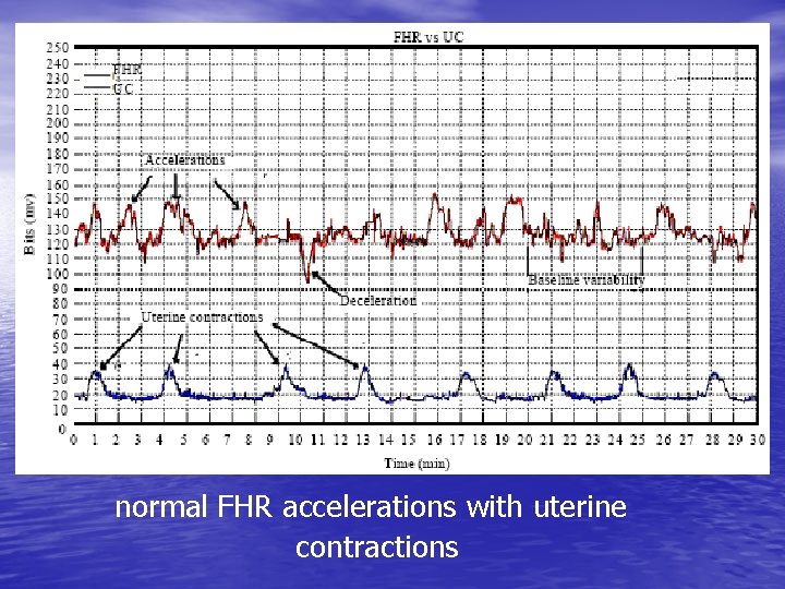 normal FHR accelerations with uterine contractions 