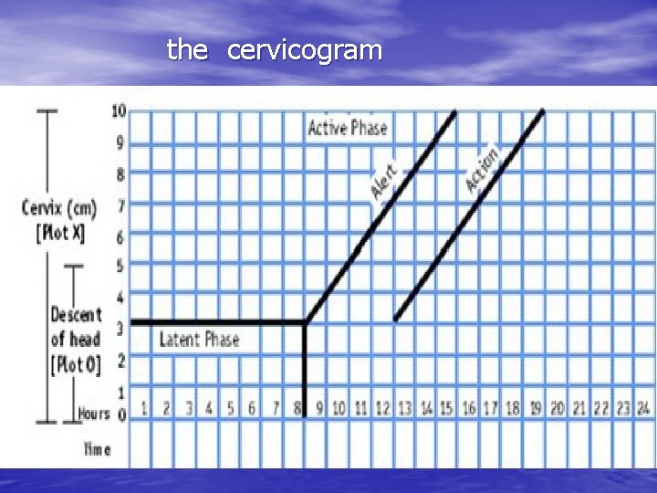 the cervicogram 