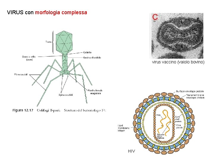 VIRUS con morfologia complessa virus vaccino (vaiolo bovino) HIV 