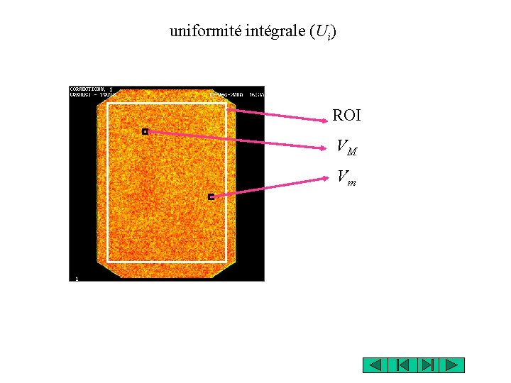 uniformité intégrale (Ui) ROI VM Vm uniformité intégrale (Ui) ROI VM Vm