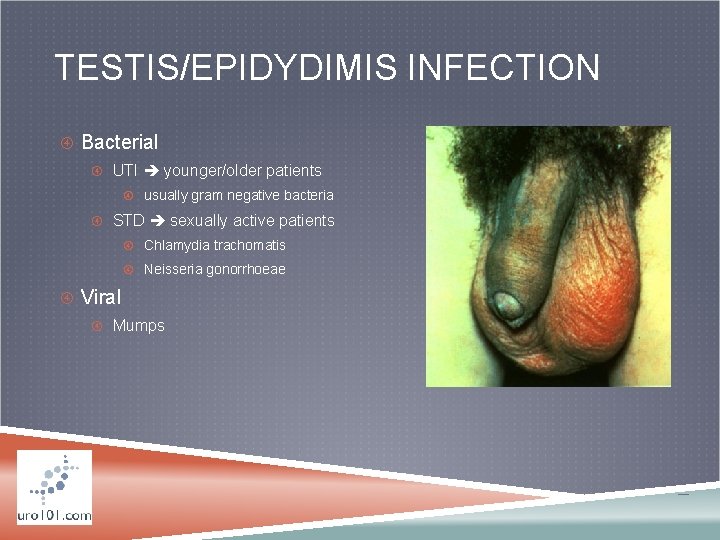 TESTIS/EPIDYDIMIS INFECTION Bacterial UTI younger/older patients usually gram negative bacteria STD sexually active patients