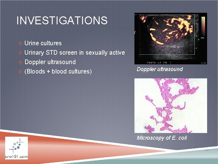 INVESTIGATIONS Urine cultures Urinary STD screen in sexually active Doppler ultrasound (Bloods + blood