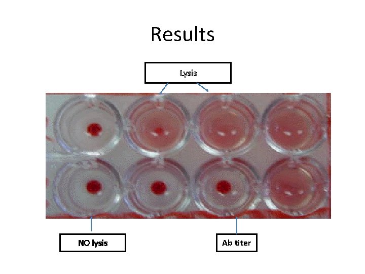 Results Lysis NO lysis Ab titer 