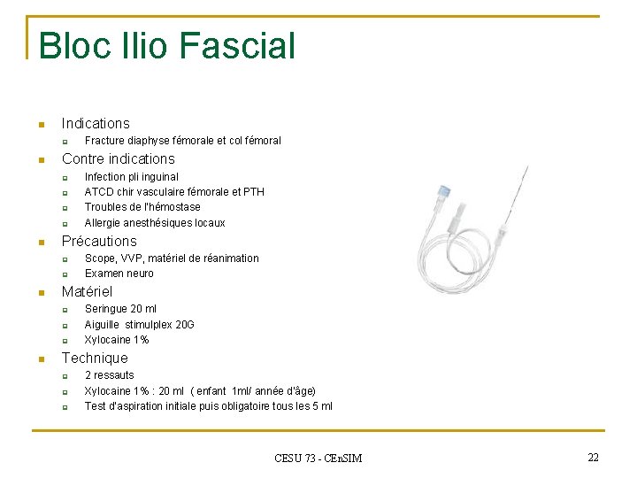 Bloc Ilio Fascial n Indications q n Contre indications q q n q Scope,