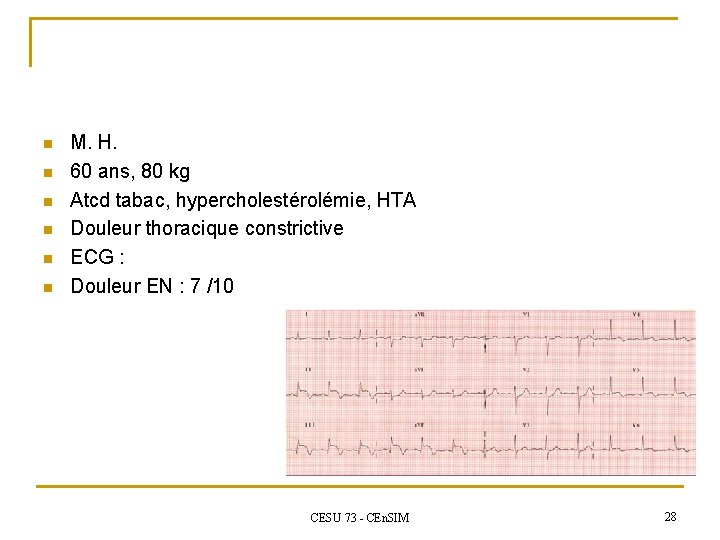 n n n M. H. 60 ans, 80 kg Atcd tabac, hypercholestérolémie, HTA Douleur