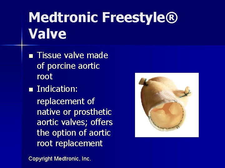 Medtronic Freestyle® Valve n n Tissue valve made of porcine aortic root Indication: replacement