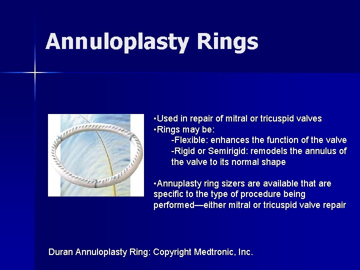 Annuloplasty Rings • Used in repair of mitral or tricuspid valves • Rings may