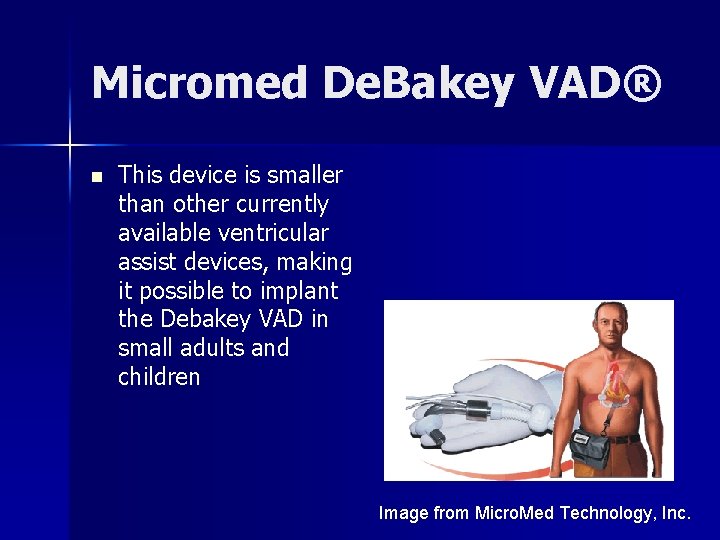 Micromed De. Bakey VAD® n This device is smaller than other currently available ventricular