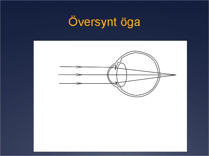 Översynt öga Konvex lins 