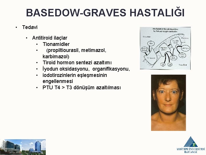 BASEDOW-GRAVES HASTALIĞI • Tedavi • Antitiroid ilaçlar • Tionamidler • (propiltiourasil, metimazol, karbimazol) •